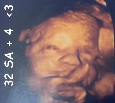 echographie grossesse t3 echographie grossesse t3